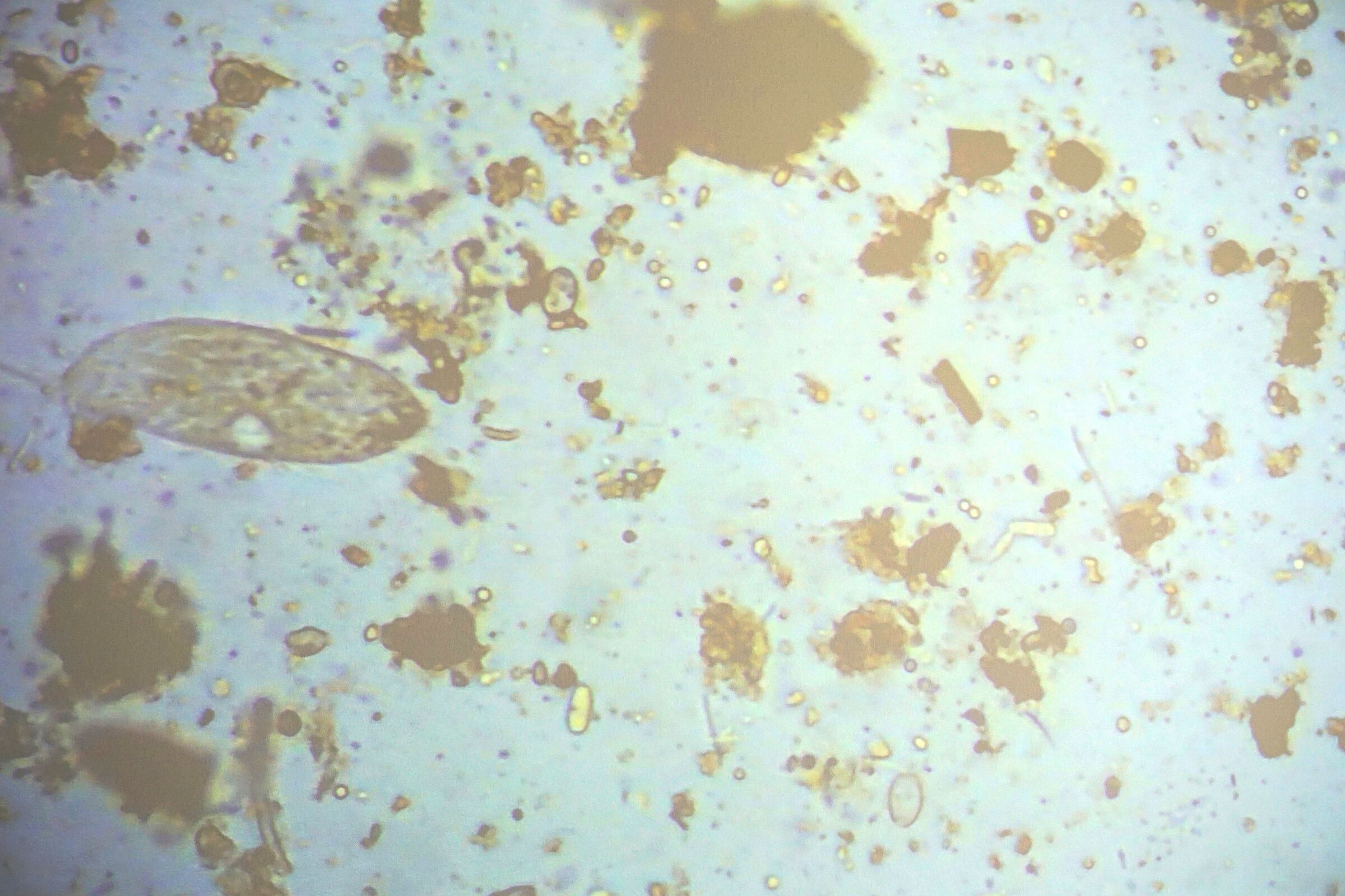 Bodenmikroorganismen unter dem Mikroskop. Foto: Ch. Starostzik Landwirtschaftstag 2022, Wartaweil